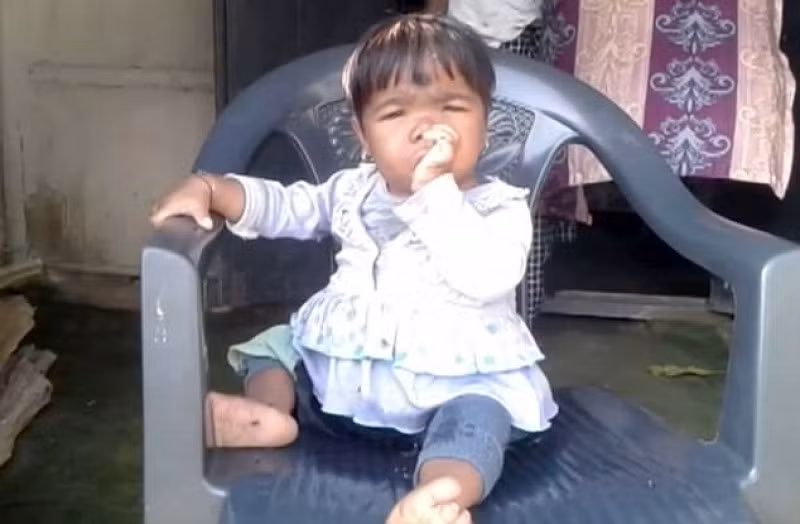 Benh gi khien co be 11 tuoi chi cao nua met, nang 10kg?