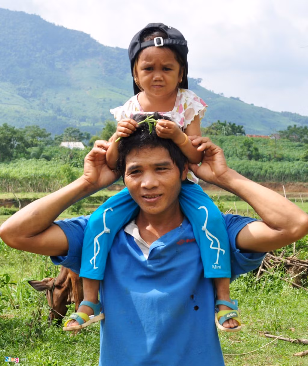 Cùng ở huyện vùng cao Sơn Hà, cô gái Đinh Thị Huyền (20 tuổi, ngụ xã Sơn Nham) hiện cũng cao khoảng 80 cm, nặng 11 kg.