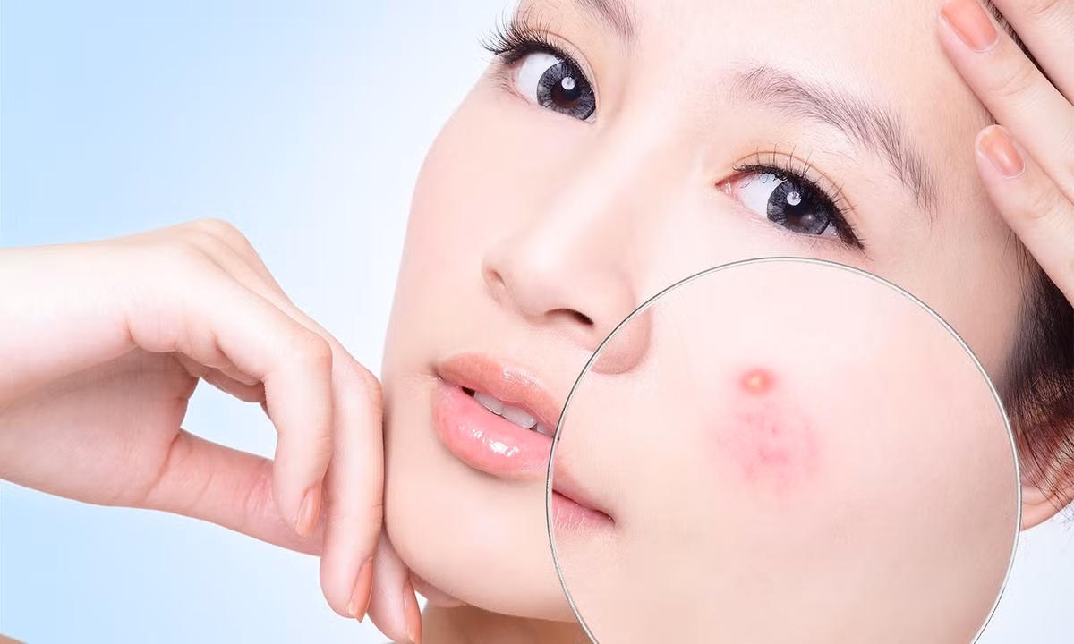 Trị mụn nhọt: Lá mồng tơi đem giã hoặc say nhuyễn (không cho thêm nước), trộn với ít muối đắp lên mụn.