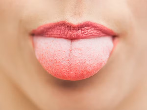 Màu sắc lưỡi thay đổi: Nếu màu lưỡi chuyển sang vàng, hơi xanh hoặc trắng thì điều này đồng nghĩa với việc máu đang chứa không ít chất độc.
