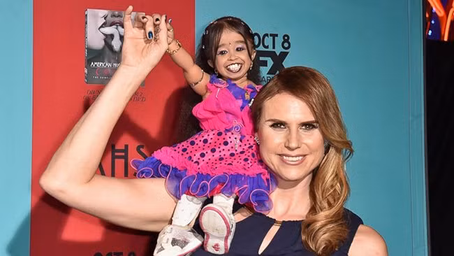 Jyoti Amge một cô gái người Ấn Độ đã trở thành người phụ nữ nhỏ nhất thế giới khi ở độ tuổi 21 cô chỉ cao có 63cm.
