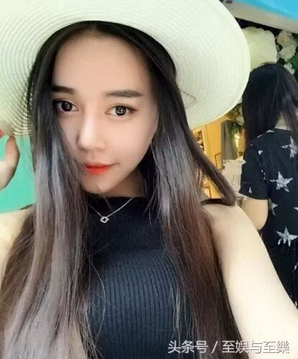 Tiểu Mỹ cho biết, phải mất gần một năm, khuôn mặt cô mới trông tự nhiên hơn.
