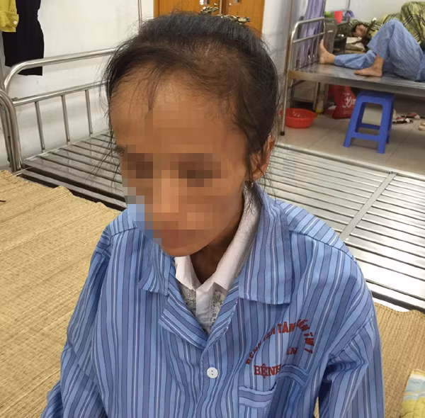 Tram cam sau sinh, ba me tre con 24kg dinh tu sat