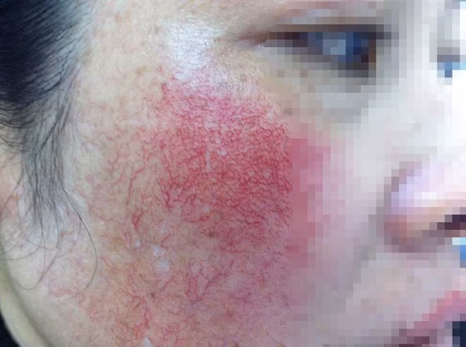 Những hóa chất độc hại trong mỹ phẩm mà bạn không biết Nhung hoa chat doc hai trong my pham ma ban khong biet