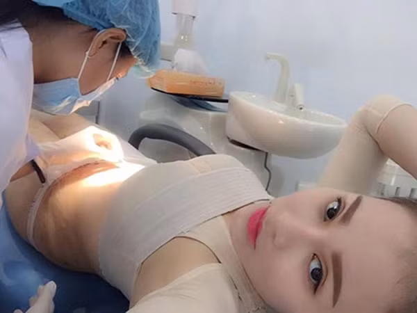 Cô đã quyết định thực hiện ca phẫu thuật tách mỡ bụng.