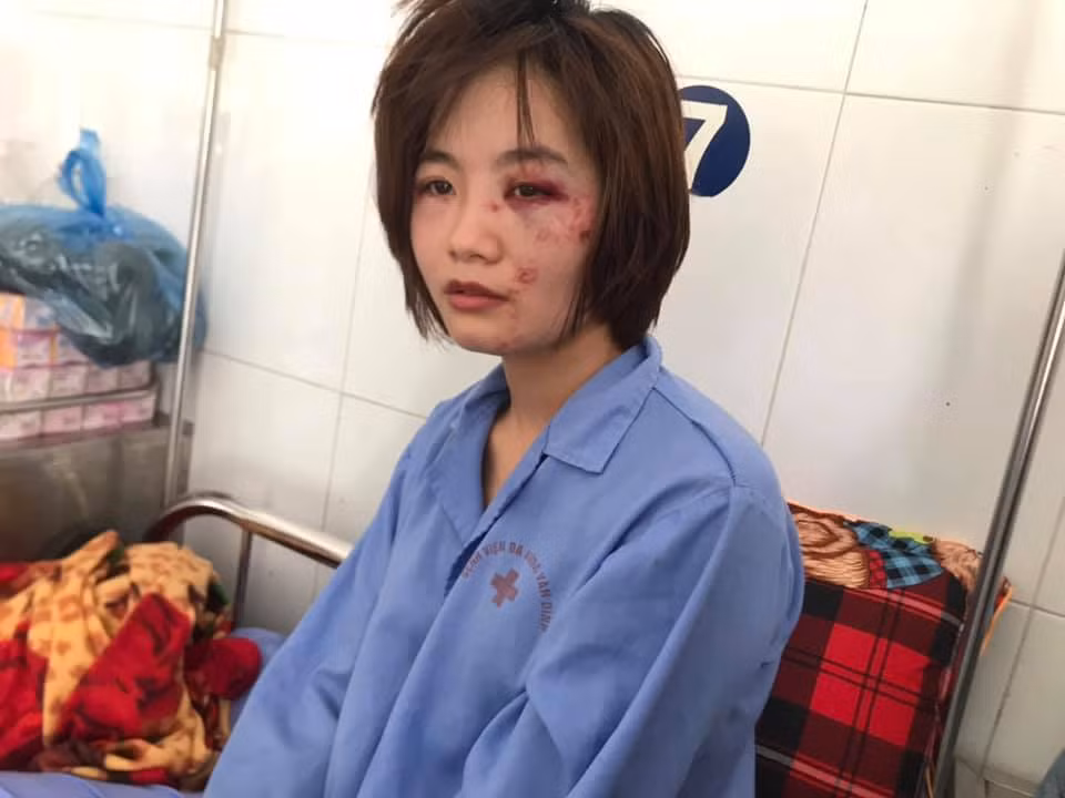 Danh tinh nhom con do xam tro danh nu nhan vien phu xe buyt