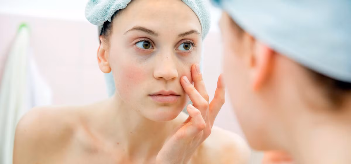  7. Tuổi tác Khi chúng ta dần lão hóa, da mất dần độ đàn hồi do sản xuất collagen chậm lại và làm mỏng da khiến cho các mạch máu trở nên dễ thấy hơn dưới da. Tình trạng suy yếu mô liên kết có thể làm cho da bị chảy xệ, mang đến một cái nhìn nặng nề, mệt mỏi như buồn ngủ.