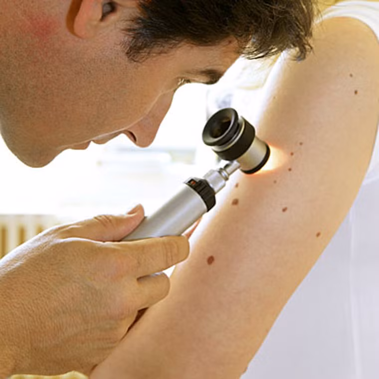  Nhằm phát hiện dấu hiệu sớm của căn bệnh, chuyên gia sức khỏe khuyến cáo nên thường xuyên thăm khám, tự kiểm tra hàng tháng. 