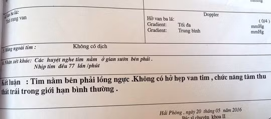 Nam thanh niên ngỡ ngàng phát hiện tim ở ngực bên phải Nam thanh nien ngo ngang phat hien tim o nguc ben phai