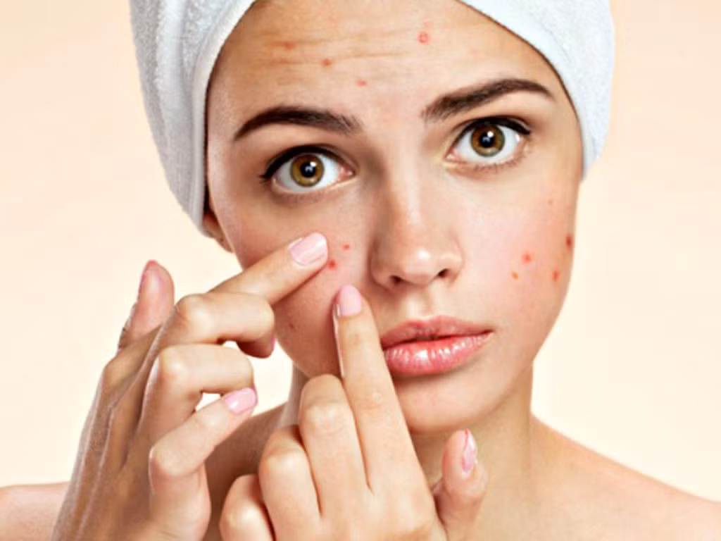 Trị mụn. Rau má được rửa sạch và cho vào máy xay sinh tố nghiền nhuyễn, đổ thêm nước ấm. Chắt lấy nước uống và bã dùng để đắp lên vết mụn. Đắp thường xuyên thì vết mụn sẽ mờ nhanh chóng. Ảnh: phunutoday.