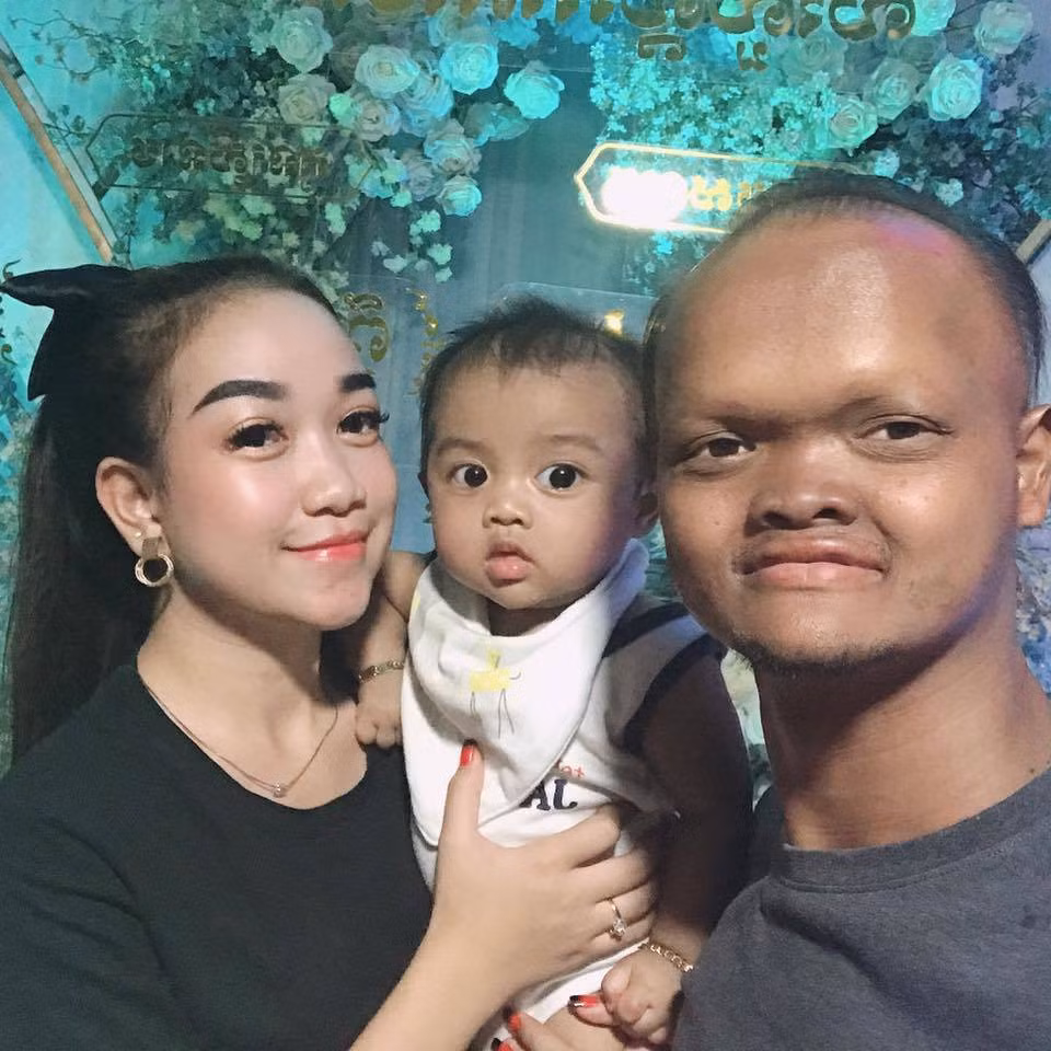 Cuoc song cua cap doi co ngoai hinh khac biet-Hinh-4