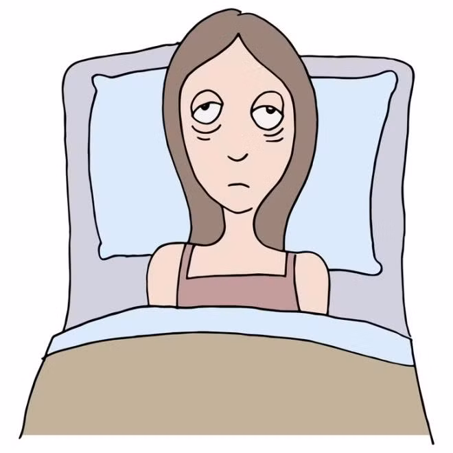 Bọng mắt: Bọng mắt là dấu hiệu cảnh báo thận của bạn đang có vấn đề. Tình trạng này xảy ra khi thận của bạn đang rò rỉ một lượng lớn protein vào nước tiểu.