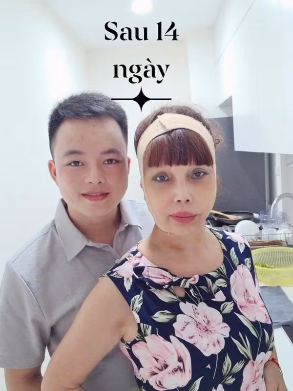 Trong suốt thời gian ấy, không ít lần cư dân mạng vô cùng hốt hoảng trước hình ảnh cô Thu Sao bị méo xệch miệng, mặt sưng húp...Ảnh: Internet, FB.