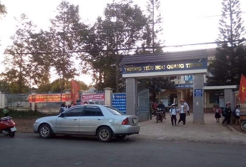 Vết thương bầm tím của học lớp 4 ở Đắk Lắk do đâu? - Hình 2 Vet thuong bam tim cua hoc lop 4 o Dak Lak do dau?-Hinh-2