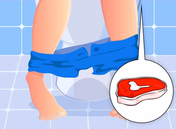 Tăng nguy cơ táo bón. Thịt động vật có ưu điểm là lượng protein vượt trội song lượng chất xơ lại rất thấp. Điều này khiến những người có thói quen ăn nhiều thịt đối diện nguy cơ táo bón cao hơn.