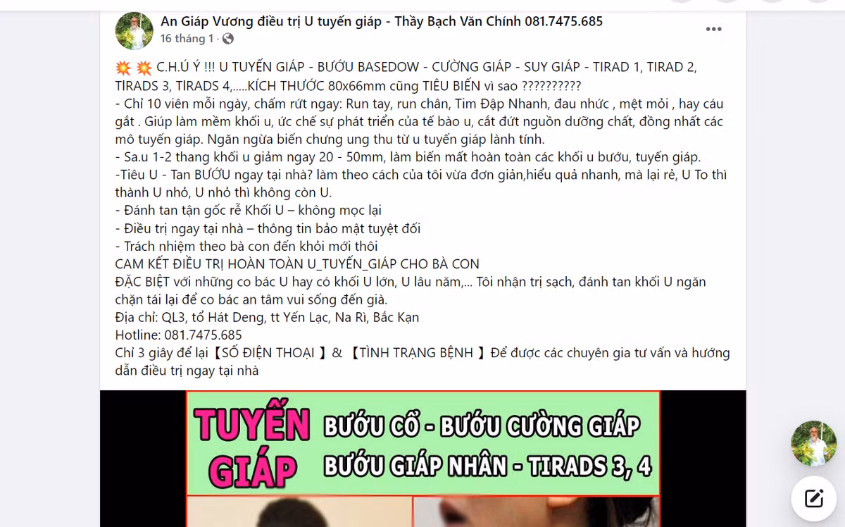 An Giap Vuong: TPCN 