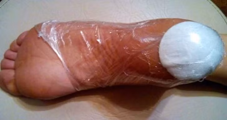 Da chân bị khô có thể là do thiếu vitamin A và E. Nó cũng có thể do sự hiện diện của việc bị nhiễm nấm. Nếu tình trạng da khô và gồ ghề không biến mất ngay cả bạn bổ sung đủ lượng vitamin, đây có thể là dấu hiệu của sự gián đoạn nội tiết.