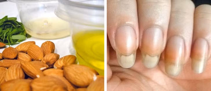 Dầu hạnh nhân chứa hàm lượng cao vitamin A, B, E, giúp dưỡng ẩm, nuôi dưỡng và sửa chữa những khiếm khuyết trên móng tay, làm mềm lớp biểu bì. Làm ấm dầu hạnh nhân, thoa đều lên móng, massage nhẹ nhàng từ 2 – 3 phút.