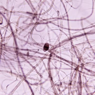 Vi khuẩn: Probiotics thường được gọi là “vi khuẩn tốt” vì chúng giúp làm giảm các vi khuẩn xấu trong cơ thể chúng ta và giảm viêm toàn hệ thống. Khi mức độ viêm thấp hơn, làn da sẽ ít mụn, đỡ khô và kích ứng.