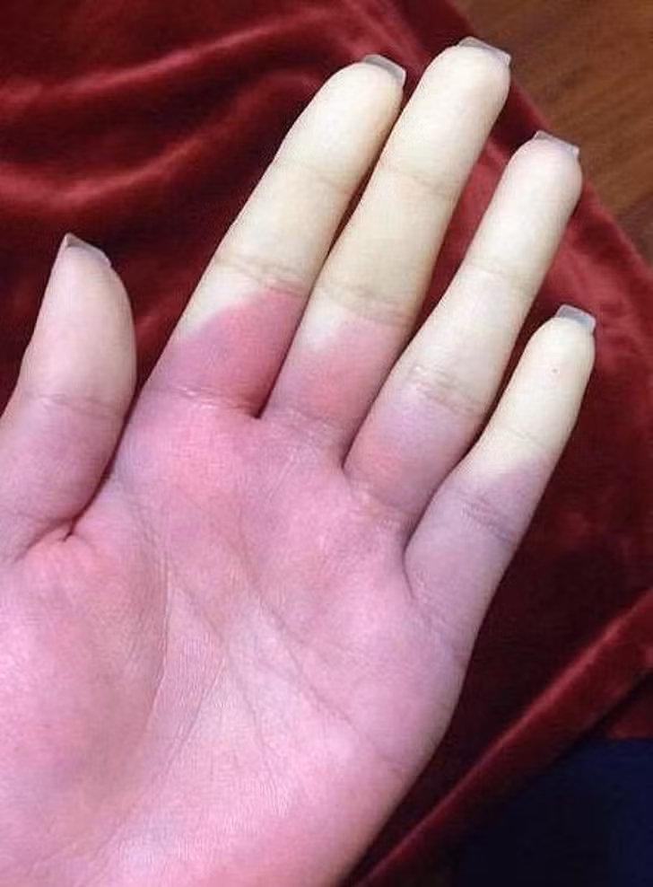 Khi mà đôi tay cũng "nhuộm" màu của rượu vang đỏ từ khi chào đời.