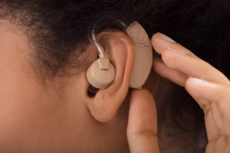 Mất thính lực: Mất thính giác dường như không gây ra những thay đổi về bộ não vật lý là đặc trưng của bệnh Alzheimer nhưng nó có thể gây ra và đẩy nhanh chứng mất trí, điều này có thể làm cho các triệu chứng của bệnh Alzheimer nghiêm trọng hơn.