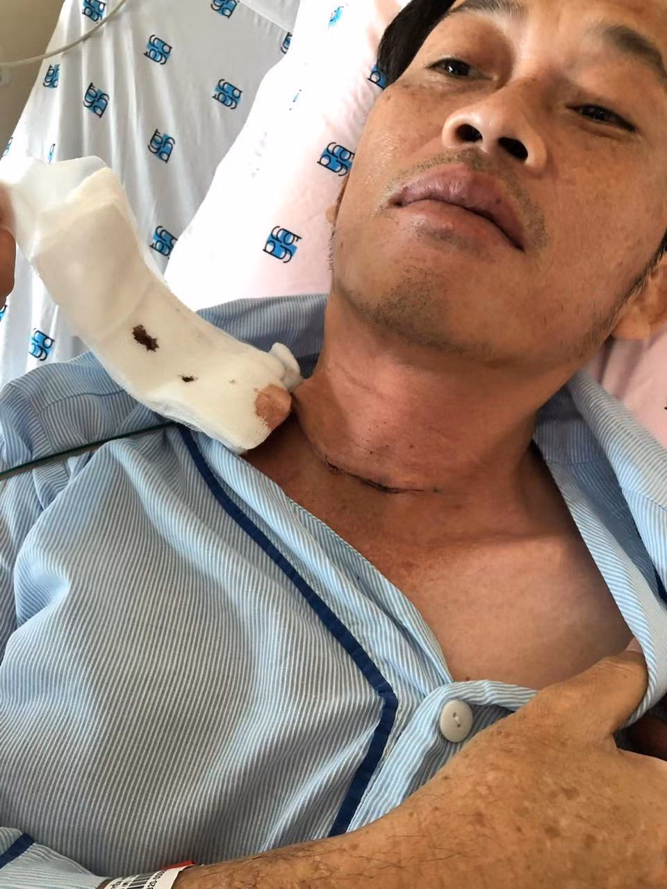 Giữa những ồn ào về việc chậm trao số tiền từ thiện hơn 13 tỷ đồng cho bà con miền Trung sau lũ lụt, đại diện nam danh hài bất ngờ thông tin Hoài Linh phải nhập viện hồi tháng 10/2020 để điều trị căn bệnh u ác tuyến giáp gây bất ngờ cho nhiều người. Ảnh: Tiền Phong.