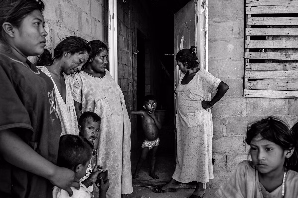 Chị Alta Guajira đang nhìn đứa con có những triệu chứng của bệnh suy dinh dưỡng. Chị đã mất 2 trong số 5 đứa cơn vì chứng bệnh do thiếu ăn này gây nên.