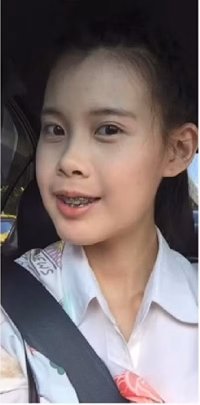 Cằm của cô gái cũng thon gọn hơn trước rất nhiều, giúp tổng thể khuôn mặt trông cân đối và "bình thường" trở lại.