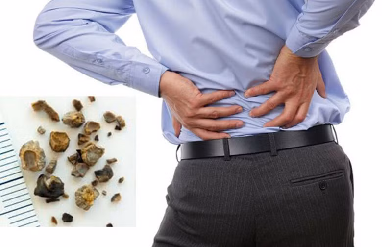Ngăn ngừa sỏi thận và nhiễm trùng bàng quang: Uống nước ngay sau khi thức dậy có vai trò quan trọng trong việc phòng ngừa sỏi thận và nhiễm trùng bàng quang. Có một sự thật rằng uống nước khi đói làm loãng axit do vậy ngăn ngừa hình thành sỏi trong thận.