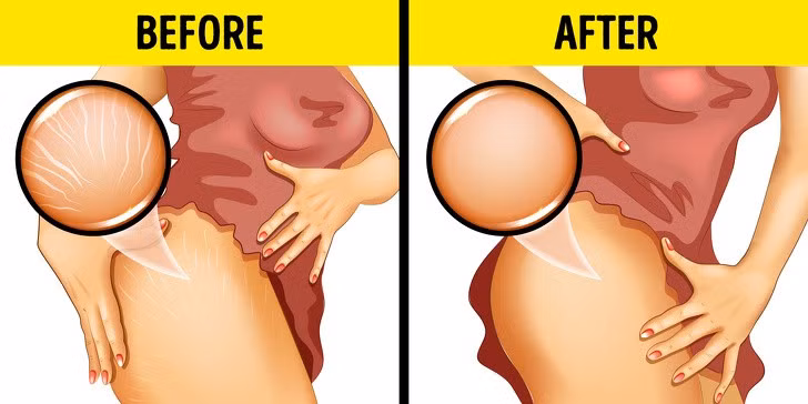 4 lợi ích nếu bạn ăn hạnh nhân mỗi ngày - Hình 3 4 loi ich neu ban an hanh nhan moi ngay-Hinh-3