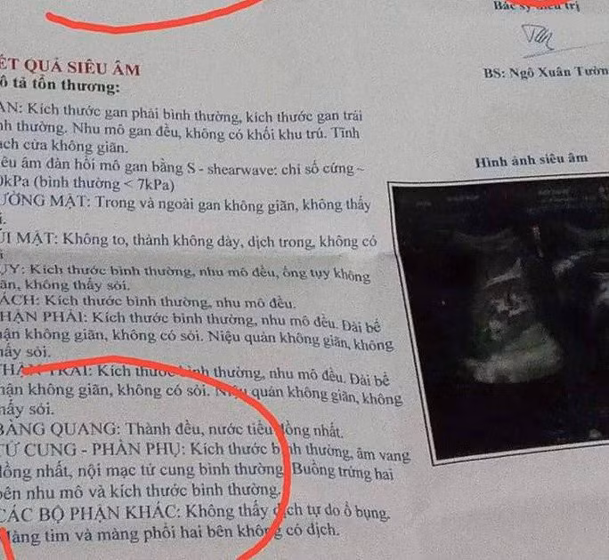 Bi hài những trường hợp bệnh viện ghi nhầm bệnh án cho bệnh nhân - Hình 2 Bi hai nhung truong hop benh vien ghi nham benh an cho benh nhan-Hinh-2