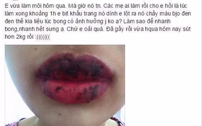Rất nhiều trường hợp xăm môi hỏng khiến môi không đều màu, viền môi bị lệch, màu xăm biến đổi không được như màu mực gốc đã chọn.