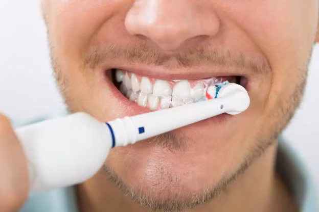 Nguyên nhân răng vàng ố là do sự tích tụ mảng bám, vì thế, đánh răng thường xuyên với kem đánh răng có thành phần làm trắng và thăm khám nha sĩ thường xuyên để làm sạch răng là cách tốt nhất để bạn ngăn ngừa ố vàng răng do cafe.