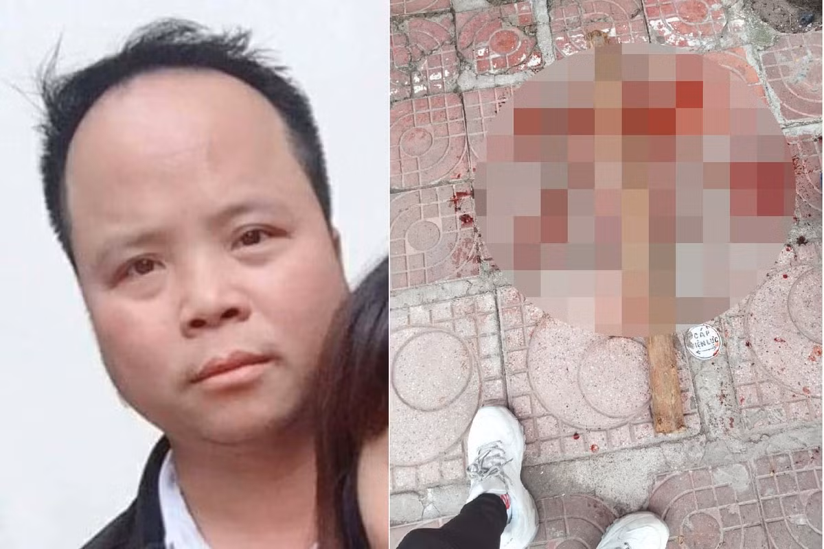 Mau thuan tinh ai, danh tinh dich gay nat 2 chan o Ha Noi