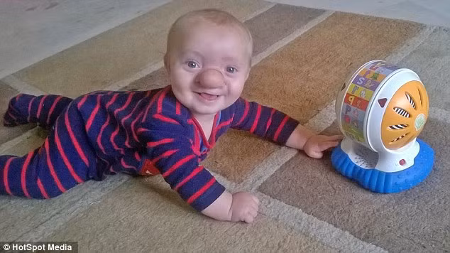 Mẹ cậu bé chia sẻ: "Đối với tôi, Ollie là đứa trẻ hoàn hảo. Đó là cậu bé Pinocchio giữa đời thực và tôi thật tự hào về con mình".