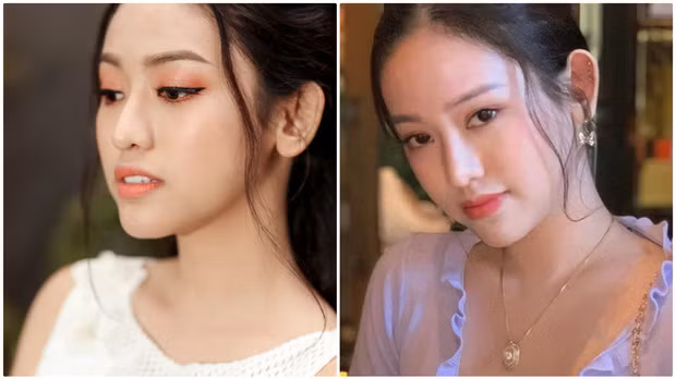 Thời điểm mới phẫu thuật, gương mặt của Thúy Vi trông rất sắc sảo, sang chảnh với thần thái cực phẩm hơn hẳn hiện tại.
