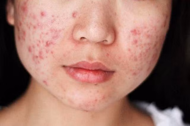 Người phụ nữ dễ mắc bệnh phụ khoa thường có 3 đặc điểm - Hình 4 Nguoi phu nu de mac benh phu khoa thuong co 3 dac diem-Hinh-4