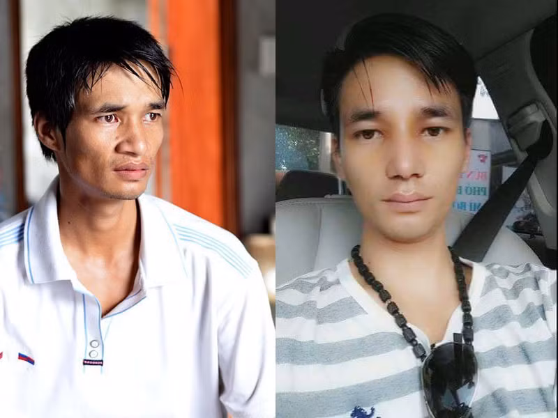 Mặc dù nhận được nhiều lời khuyên nên cân nhắc trước khi nhờ đến sự can thiệp của "dao kéo" nhưng hôm 23/7 vừa qua Lệ Rơi (tên thật Nguyễn Đức Hậu, sinh năm 1987, ở Hải Dương) vẫn quyết định tiến hành phẫu thuật thẩm mỹ một vài điểm thiếu hài hòa trên khuôn mặt như chiếc mũi hơi to và bè ra. Ảnh: FBNV.