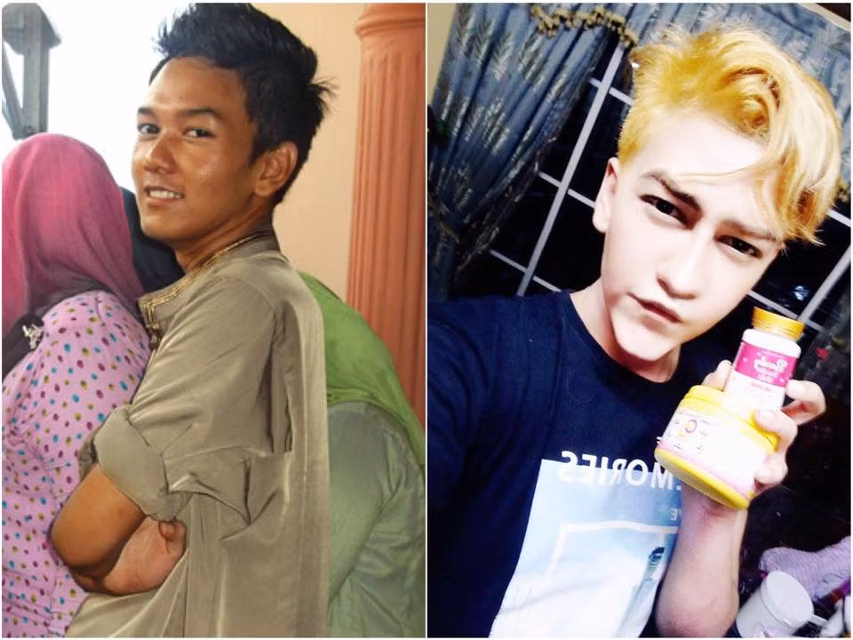 Sau khi được lan truyền từ hôm 2/7 vừa qua, loạt ảnh gương mặt sau phẫu thuật thẩm mỹ khiến Miyyo bỗng dưng nổi tiếng. Mặc dù vậy, anh chàng cũng đã phải nhận nhiều chỉ trích trên mạng, thậm chí còn bị xúc phạm cả khi đi ra đường.