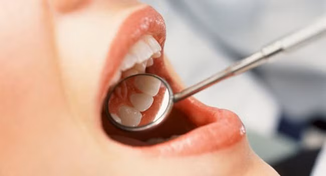 Răng cũng giống như dấu vân tay, nghĩa là bộ răng ở mỗi người là duy nhất, không ai giống ai. Ngay cả những cặp song sinh giống hệt nhau cũng không có hàm răng giống hệt nhau. (Nguồn Vienyhocungdung)