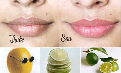 Sử dụng chanh bạn có thể hết thâm môi đơn giản.