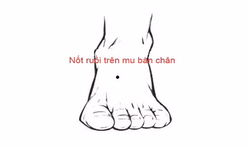 Not ruoi tren ban chan noi len dieu gi?