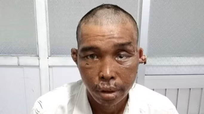 Bat them 1 doi tuong vu ngu dan bi hanh ha da man