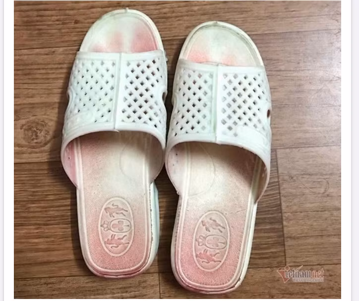 Người Việt đầu tiên mắc bệnh mồ hôi máu giờ ra sao? - Hình 2 Nguoi Viet dau tien mac benh mo hoi mau gio ra sao?-Hinh-2