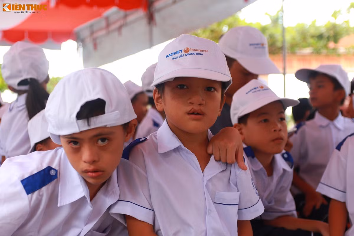 Các trẻ em khuyết tật vốn là những mảnh đời bất hạnh, các em không được may mắn để có cuộc sống bình thường như bao trẻ em khác. Ảnh: Quốc Minh.