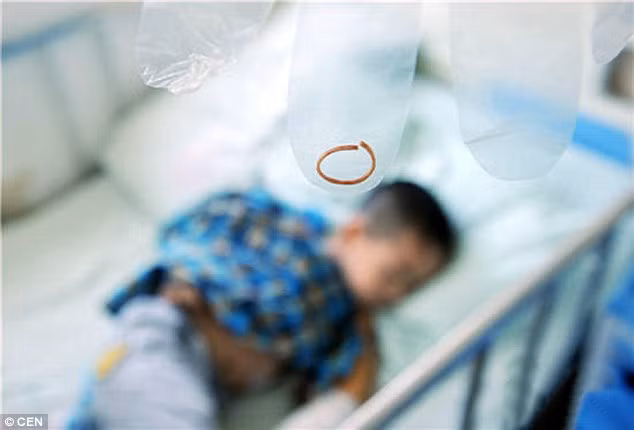 Kết quả chụp X-quang cho thấy chiếc chun đã ảnh hưởng đến phần xương cổ tay khiến bé không thể duỗi thẳng tay trái. “Nếu không kịp thời tháo được chiếc chun ra, Longlong có thể sẽ bị mất đi một phần cánh tay trái” – bác sĩ cho biết. Sau ca phẫu thuật, bé Longlong cũng đã thừa nhận rằng trước đó có đeo chun vào cổ tay nhưng hiện vẫn không xác định được đó là thời điểm nào. 