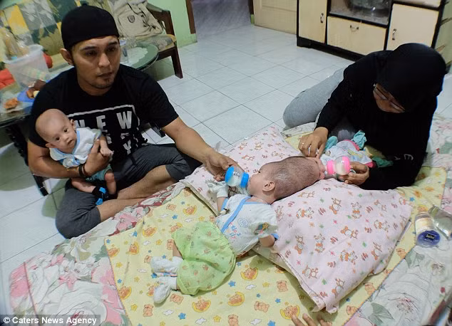 Cặp chị em song sinh Nadira Alifa Putri và Nadiba Aisyah Putri được sinh ra trong một ca mổ sinh ba tại một bênh viện ở Indonesia. May mắn cho gia đình là một trong số 3 chị em được sinh ra như một đứa trẻ bình thường, và cũng không may cho Nadira và Nadiba khi hai chị em bị dính liền hộp sọ. 