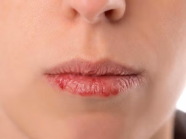Kem dưỡng môi không chỉ dành riêng cho phụ nữ. Đàn ông có đôi môi khô nứt cũng gây mất cảm quan đối với phụ nữ. Vì thế đừng ngại mang theo dưỡng môi nếu môi bị khô.