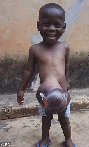 Vào năm 2015 một bác sĩ người Anh tên là David Williams đã đến Ghana thăm con gái đang dạy tiếng Anh và làm phát thanh viên tại nước này đã tình cờ gặp Charles, bố của bé Ethan và được nhờ khám cho cậu bé. 