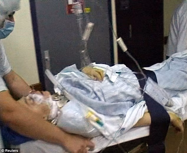 Chính bác sĩ Meningaud, một trong hai bác sĩ phẫu thuật chính lúc đó và nhiều ca phẫu thuật sau này cũng đã thừa nhận về trước mắt và trung hạn thì ca phẫu thuật thực sự có tác dụng nhưng về lâu dài thì không được như mong muốn. Ông cho biết bệnh nhân gặp nhiều vấn đề với thuốc chống đào thải hơn bác sĩ dự đoán lúc ban đầu và còn cần phải theo dõi về sau. “Đó là cái giá khá cao mà bệnh nhân phải trả, và đã đến lúc nên tạm dừng lại”. 